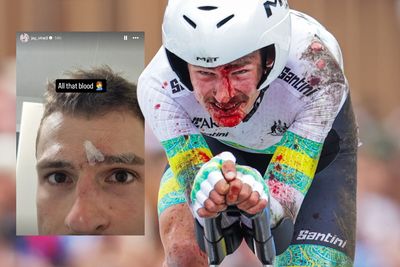 Jay Vine receives three stitches for head wound suffered in World Championships crash