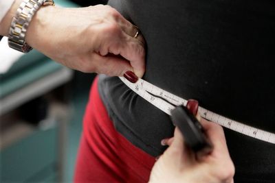 Severe obesity is on the rise in the US