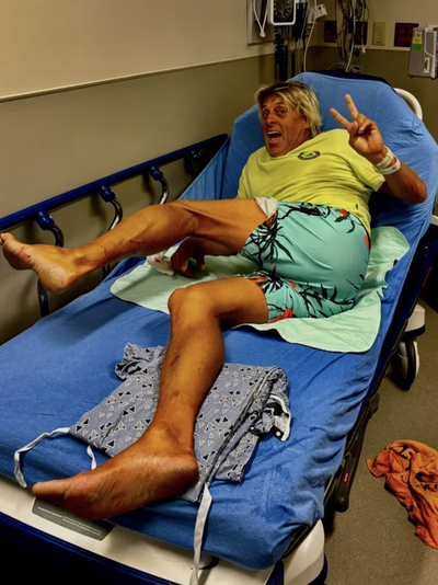 Veteran Florida Surfer Accidentally Steps On Shark, Gets 'Gnarly' Bite: Felt Like I Stepped 'on a Light Socket'