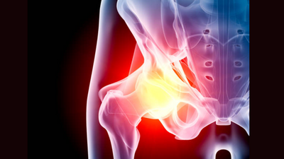 Understanding different types of hip arthritis