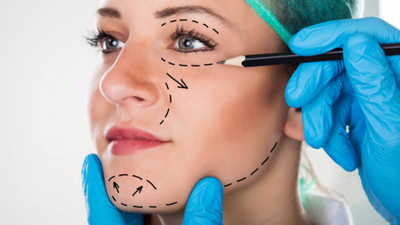 What to expect after a facelift procedure