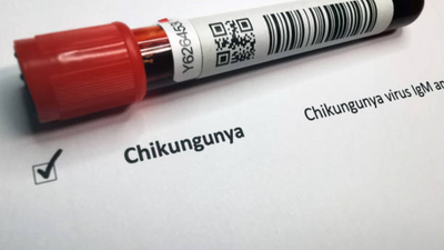 How does chikungunya spread and what are its symptoms