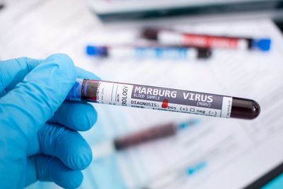 Marburg virus: Should UK travellers be worried about the disease?