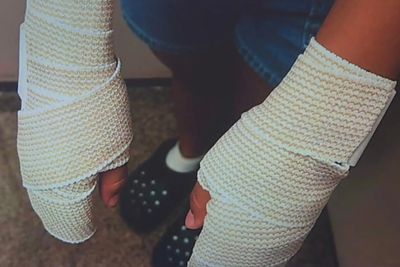 Preteen Cheerleaders Suffer Severe Burns After Coach Forces Them to Crawl a Mile on 125-Degree Pavement: 'It Was Malicious'