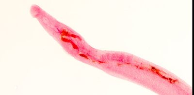 Tracking vampire worms with machine learning − using AI to diagnose schistosomiasis before the parasites causing it hatch in your blood