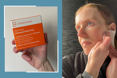 14 best chemical peels for glowy, brighter skin