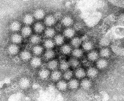 Norovirus vaccine: How does the trial work, when could it be available and what will it mean for the NHS?