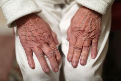 £20m initiative to tackle ‘historically low’ numbers in dementia clinical trials