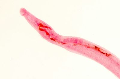 This Forgotten Parasite Is More Common Than You Think — Can AI Help Detect It?