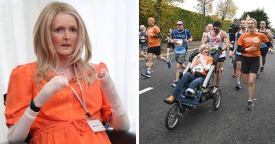 Farrell Finishes Marathon With Ireland’s Oldest Surviving Person With Epidermolysis Bullosa