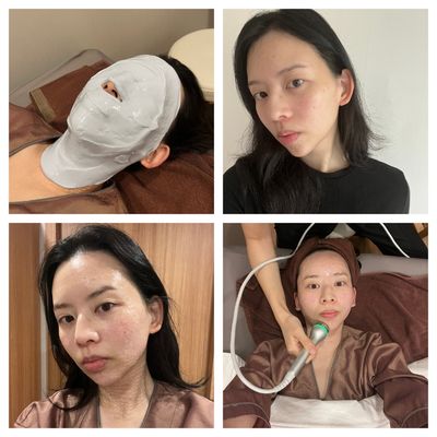 I Flew to Seoul to Try Salmon Sperm Injections for My Skin