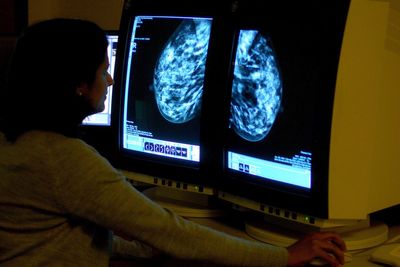 ‘Huge breakthrough’ in breast cancer drug therapy ‘doubles survival time’