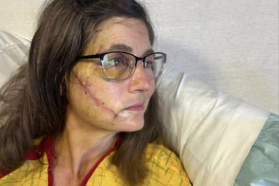 Texas Woman Viciously Bludgeoned in Random Lunchtime Attack Breaks Silence: 'Those Entire Two Days are Completely Gone'