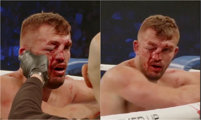 Most horrific damage ever? BKFC fighter’s face caves in during bout