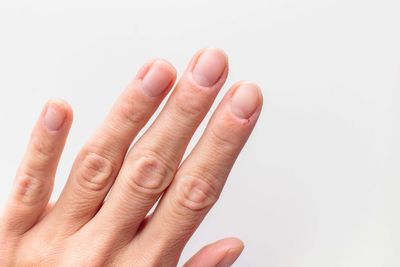 How to stop dry and cracked cuticles