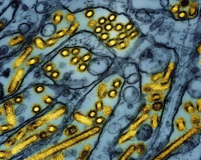 British Columbia Teen Confirmed With Bird Flu Virus