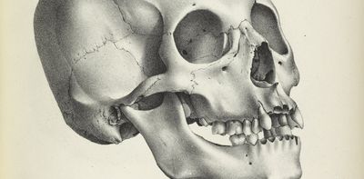 Hundreds of 19th-century skulls collected in the name of medical science tell a story of who mattered and who didn’t