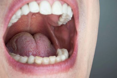 No need for a hospital trip: How London doctors are using photos to help diagnose mouth cancer