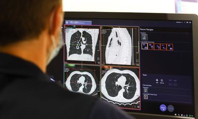 British Bangladeshi men have highest rates of lung cancer in England