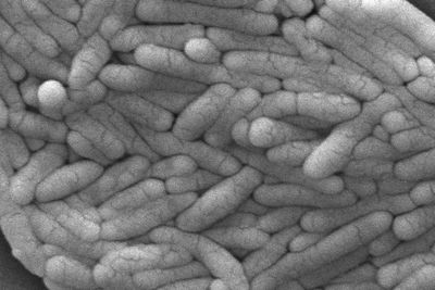 Scientists hope salmonella could hold the key to treating bowel cancer