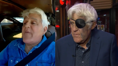 What Happened To Jay Leno's Face: Talk Show Host Says Black And Blue Bruises Aren't 'A Big Deal'