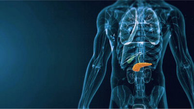 3 biggest misconceptions about Pancreatic Cancer: What we can do to reduce risk