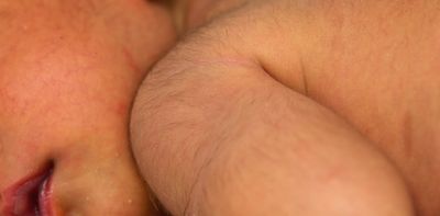 Why are some babies born so hairy? Lanugo is more common in early babies but is nothing to worry about