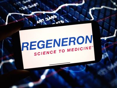 Do Wall Street Analysts Like Regeneron Pharmaceuticals Stock?