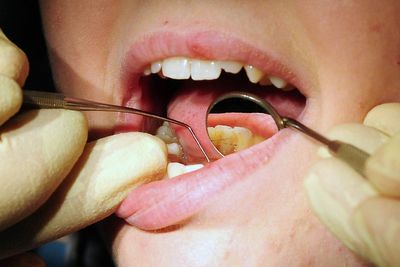 Spending watchdog warns plans to boost NHS dental treatments 'not on track'