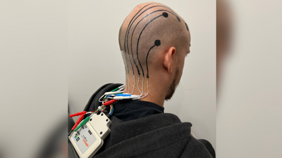 'Electronic' scalp tattoos could be next big thing in brain monitoring