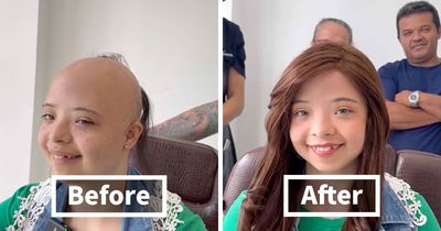 Heartwarming Transformations: 20 Pictures Of Kids Receiving Hair Prosthetics From This Barber