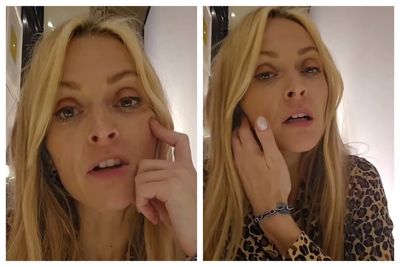 Fearne Cotton shares health update after undergoing jaw surgery to remove benign tumours