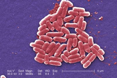 Vaccine targeting common gut bacteria E.coli could help prevent cancer, scientists suggest