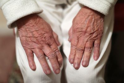 Dementia remains UK’s leading cause of death, analysis finds