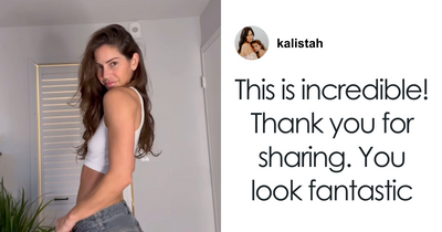 Australian Boxer Stuns With Body Transformation After Removing Breast Implants