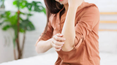 How to handle winter psoriasis: Tips from a dermatologist