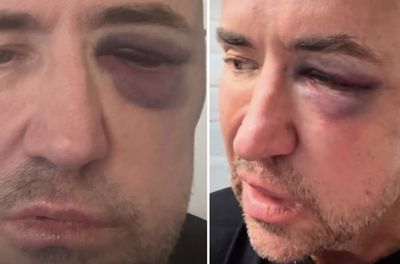 Man arrested after DJ Fat Tony left with ‘horrific’ facial injuries in gig attack