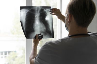 Not Just For Smokers: Young Non-Smoker Died Of Terminal Lung Cancer After Symptoms Were Initially Dismissed As Anxiety