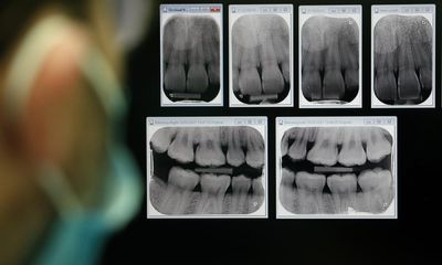 How soaring fees for private care are deepening England’s dentistry crisis