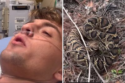 Snake-chasing social media star hospitalized after being bitten by venomous rattlesnake