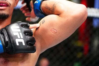 Head stomps, biting, double KOs, infamous DQs among UFC’s strangest fight endings of all time