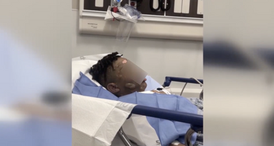 Georgia Preteen Disfigured After Friends Pour Hot Water on His Face During Sleepover 'Prank'