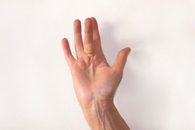 What is Dupuytren’s contracture and how serious is it?