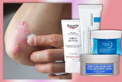 Best creams for psoriasis, as recommended by a dermatologist