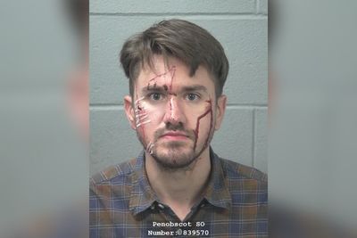 A Texas Man Claimed His Girlfriend Tried to Kill Him. Police Say He Cut His Own Face With a Razor to Frame Her