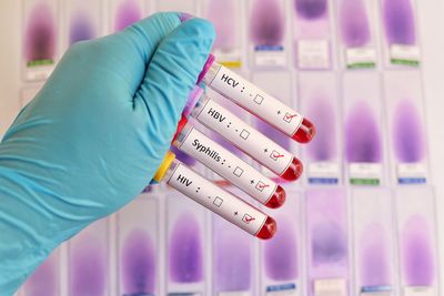 A new treament slowing the STI crisis?