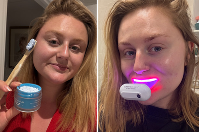 10 best teeth whitening kits, expert-tested to reverse staining