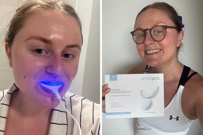 10 best teeth whitening kits, expert-tested to reverse staining