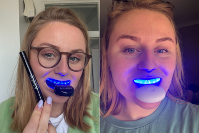 Best teeth whitening kits 2026, expert-tested to reverse staining
