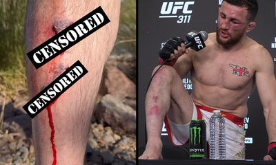 Merab Dvalishvili shares graphic footage of pre-UFC 311 injury he hid from commission